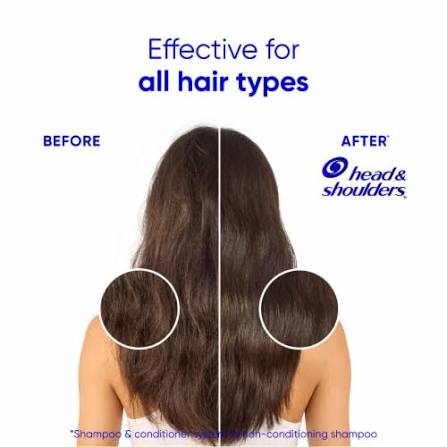 Head & Shoulders Moisture Scalp Care & Smoothing Conditioner (360 ml)