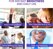 Jan London Teeth Whitening Foam for Aligners and Retainers
