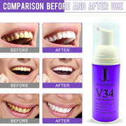Jan London Teeth Whitening Foam for Aligners and Retainers